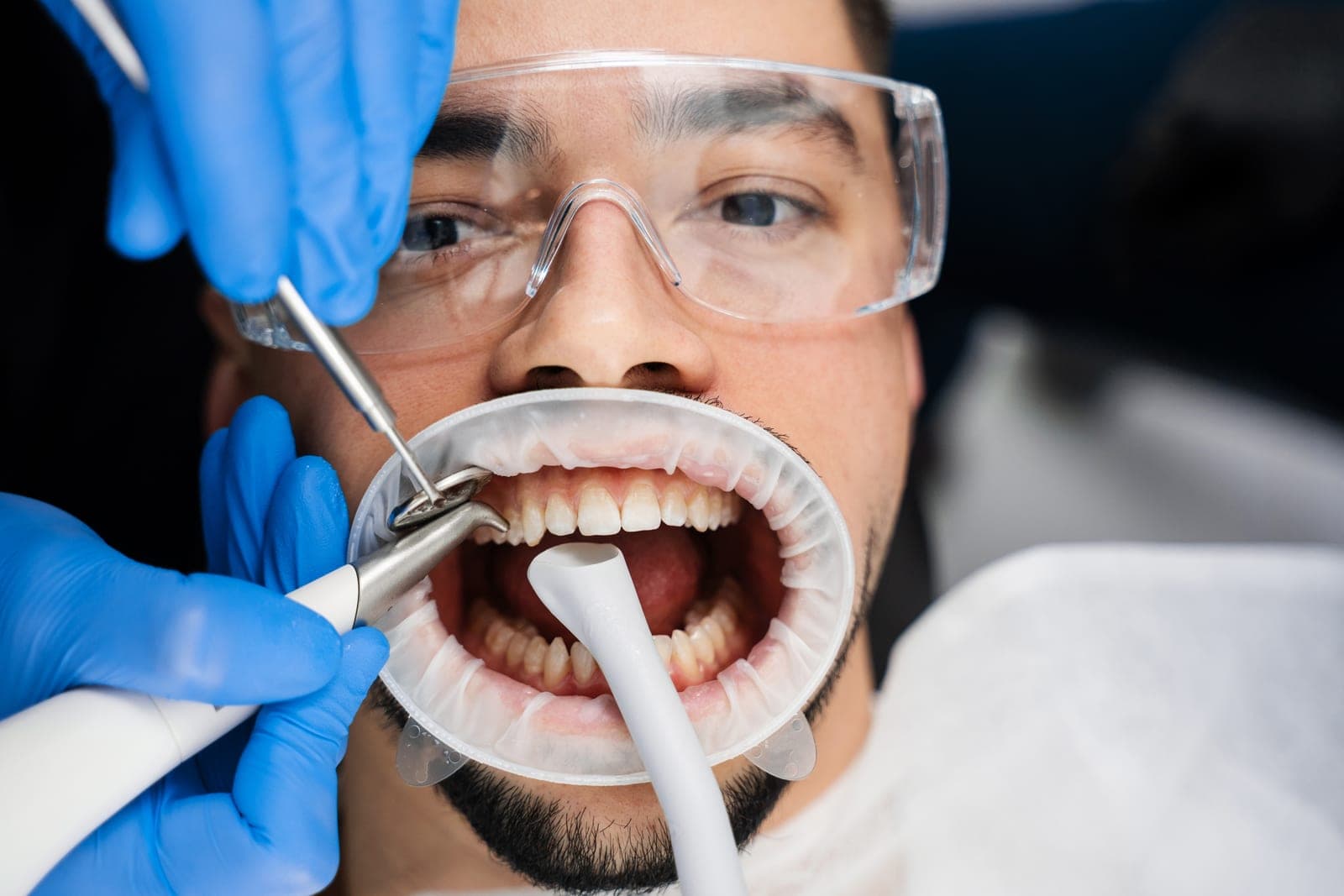 Limpieza dental profesional con airflow en Arcodental Getafe
