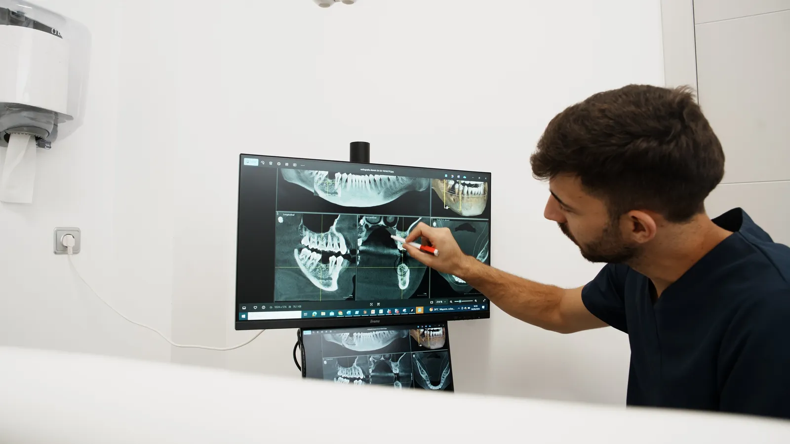 Planificación de implantes con TAC 3D en Arcodental Getafe