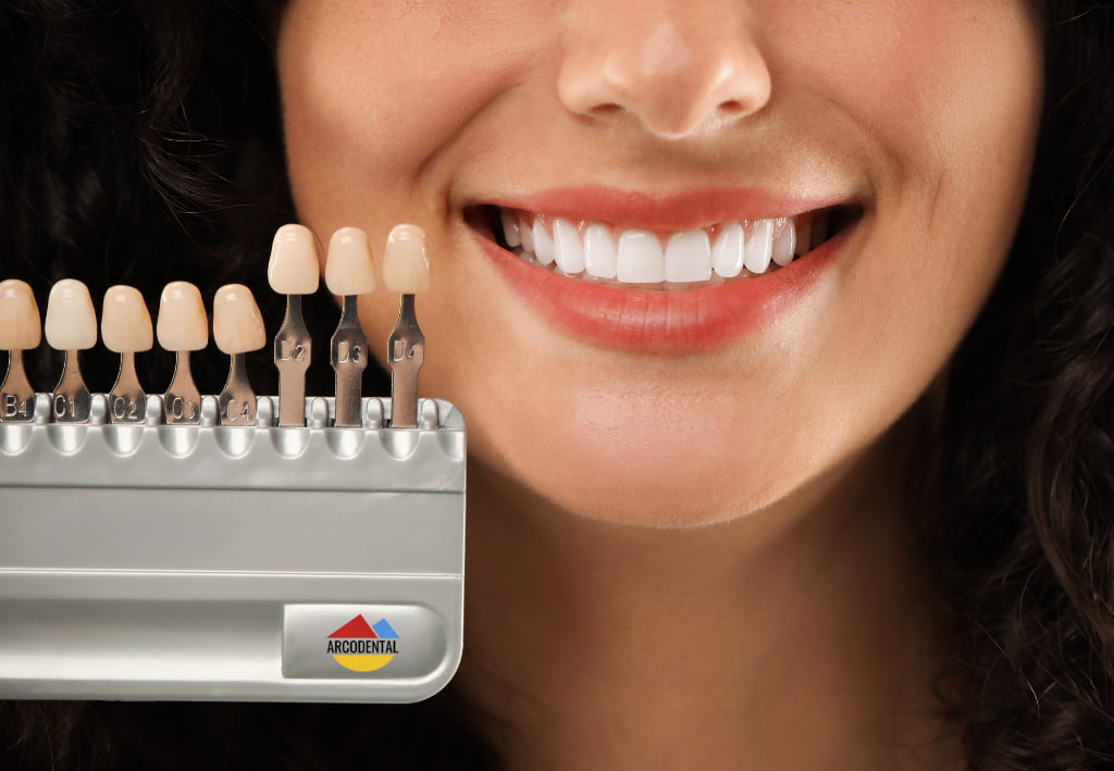 carillas dentales getafe