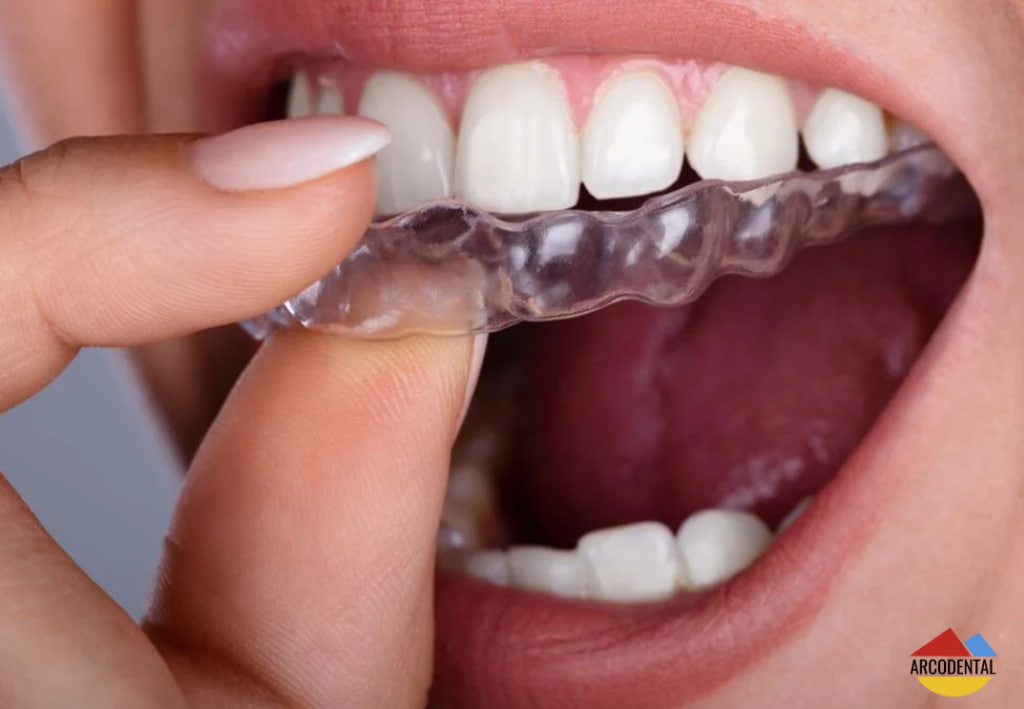 invisalign getafe