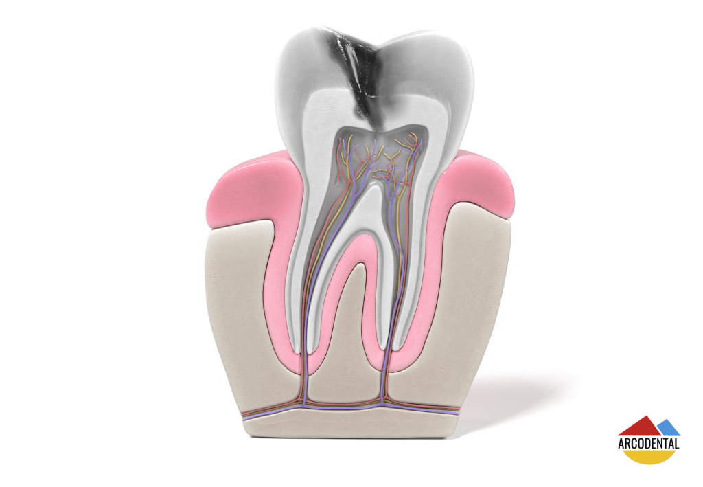 endodoncia en getafe