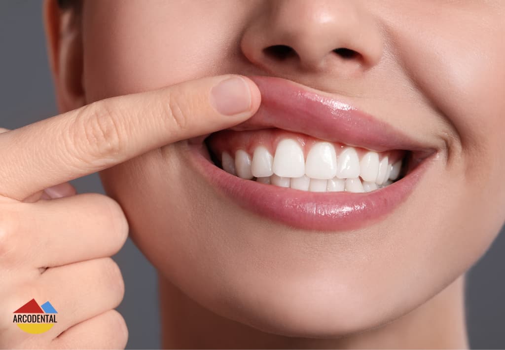 gingivectomia getafe