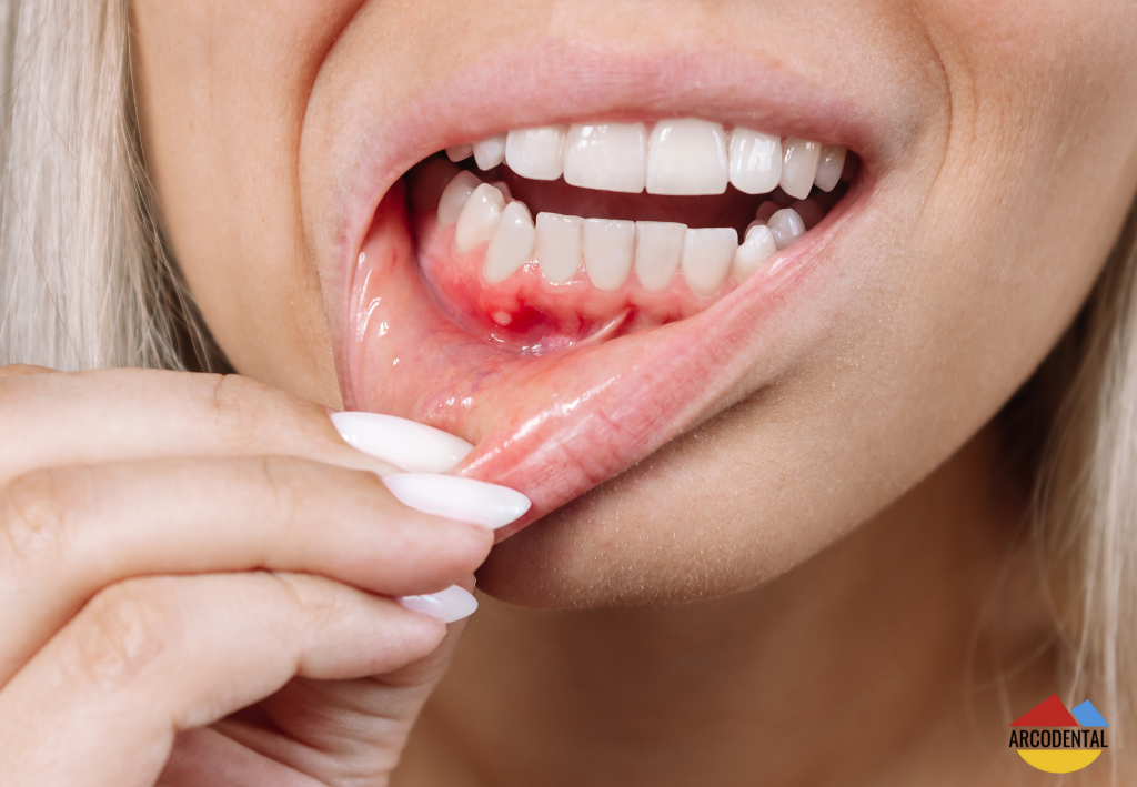 periodoncia en getafe