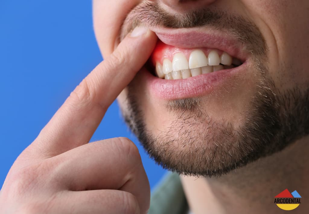 reduccion de encias getafe